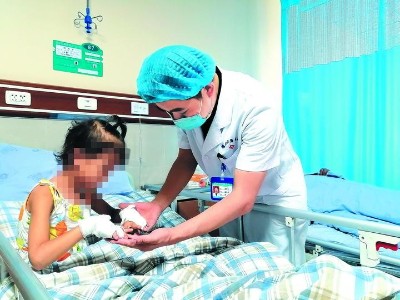 雅安仁康醫院創傷顯微外科多措并舉治療小女孩雙手并指畸形